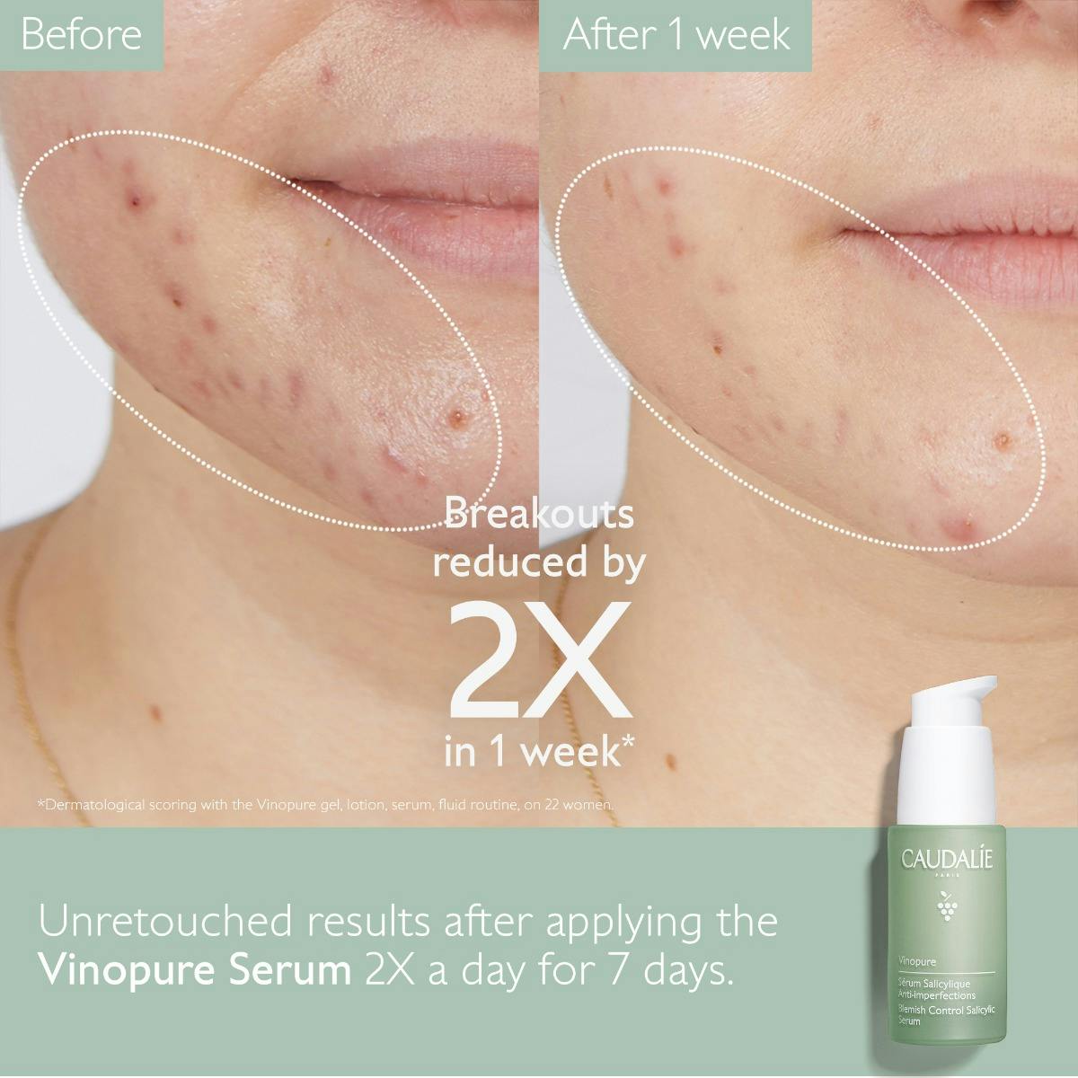Natural Salicylic Acid Pore Minimizing Serum