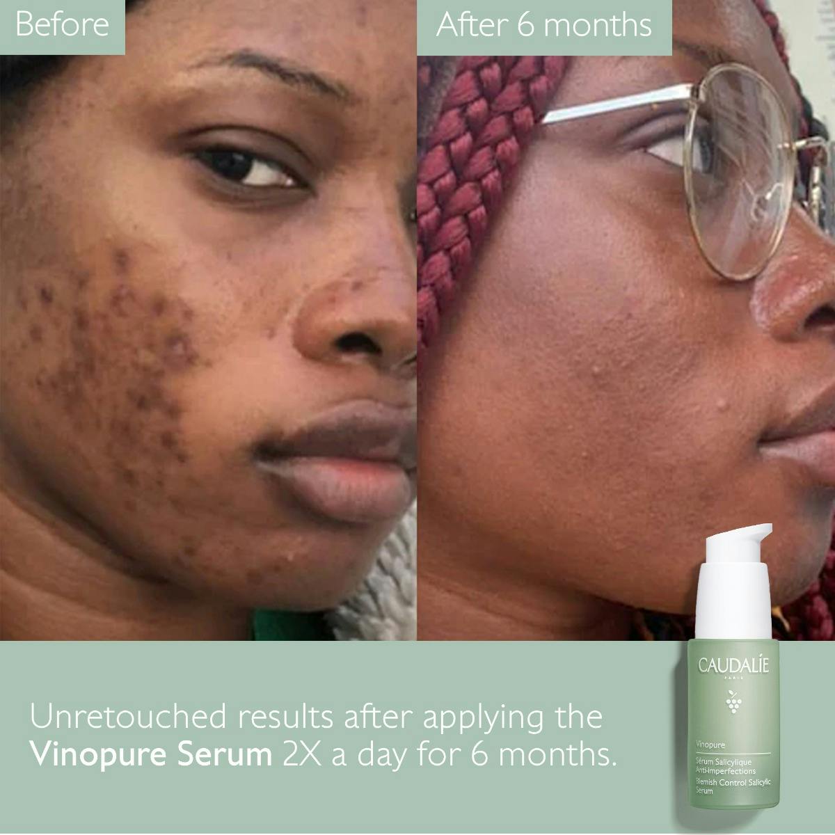 Natural Salicylic Acid Pore Minimizing Serum