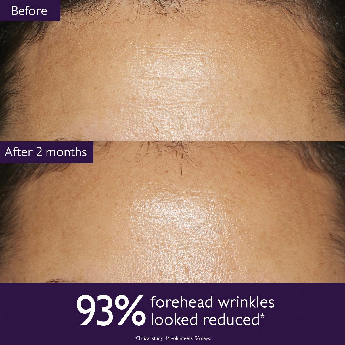 Anti-Aging Set for Fine Lines and Wrinkles