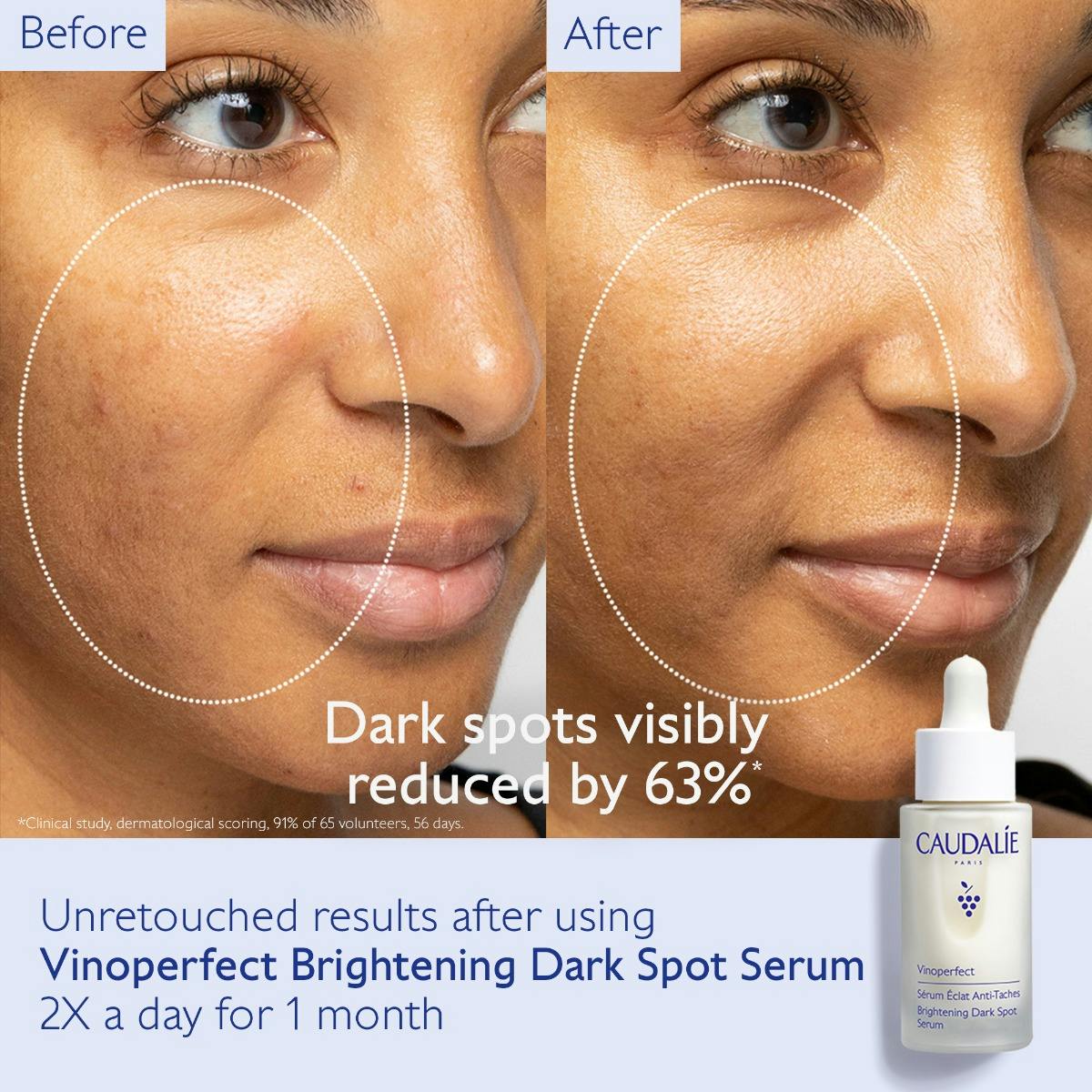 コーダリー Vinoperfect Serum&Suncare Set 2025 Caudalie Vinoperfect Serum & Suncare Set | Bath & Unwind