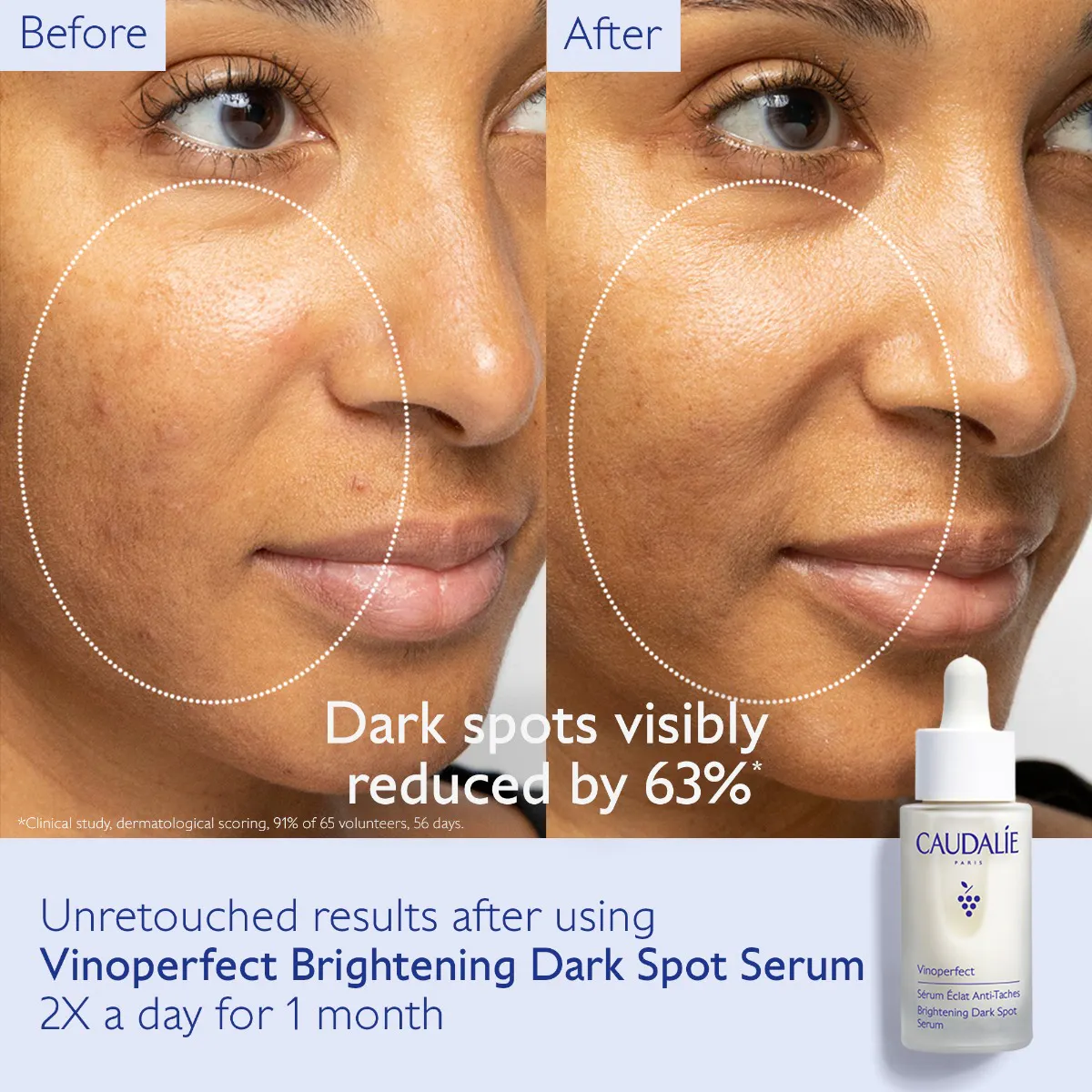 Brightening Routine Set for Dark Spots and Uneven Skin Tone