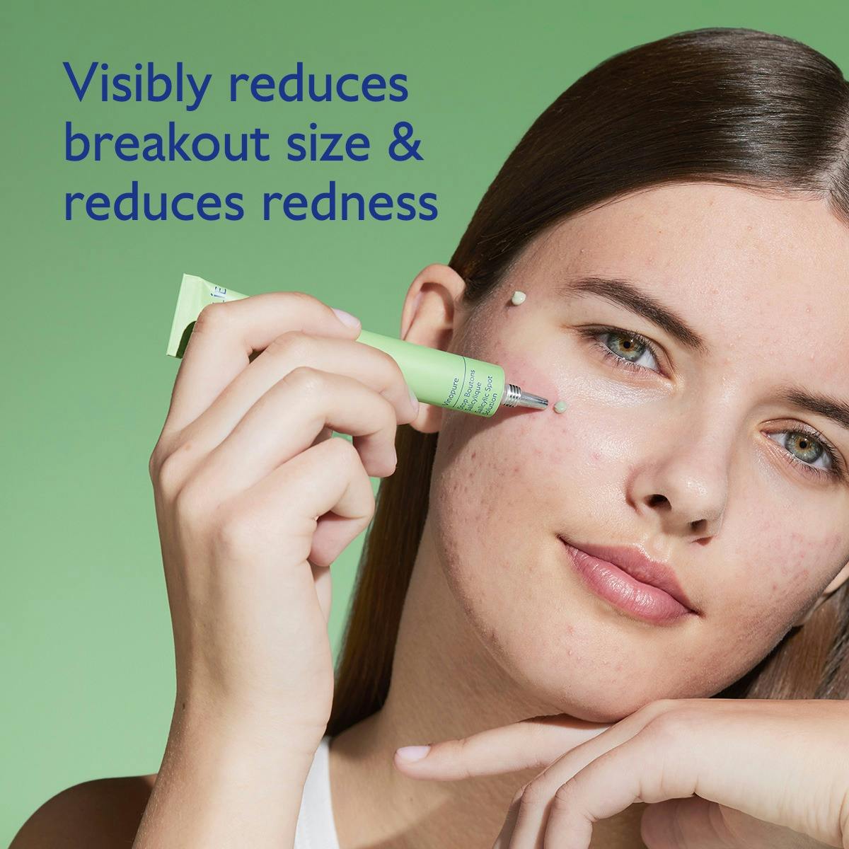 Targeted Spot Solution with Salicylic Acid