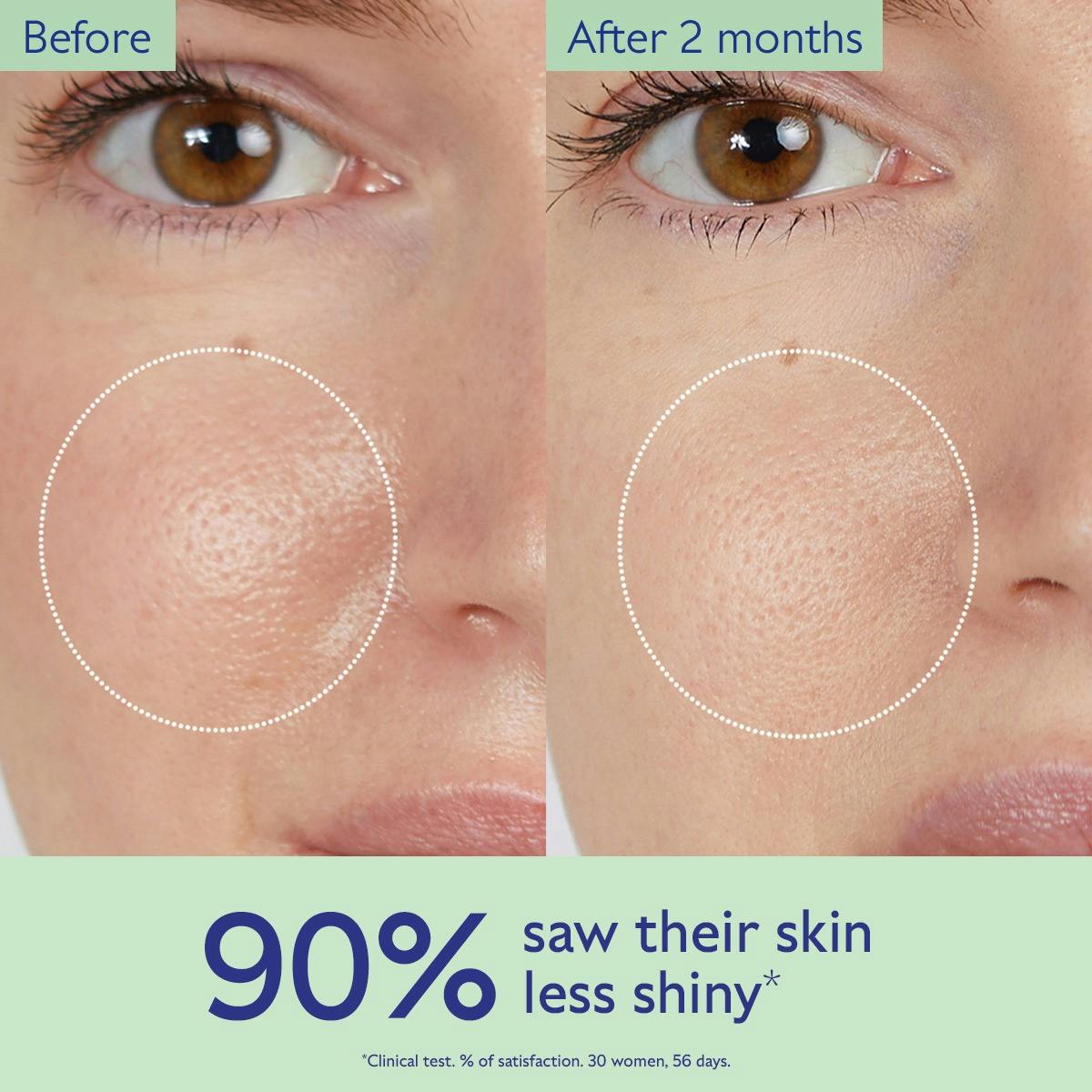 Natural Salicylic Acid Pore Minimizing Toner