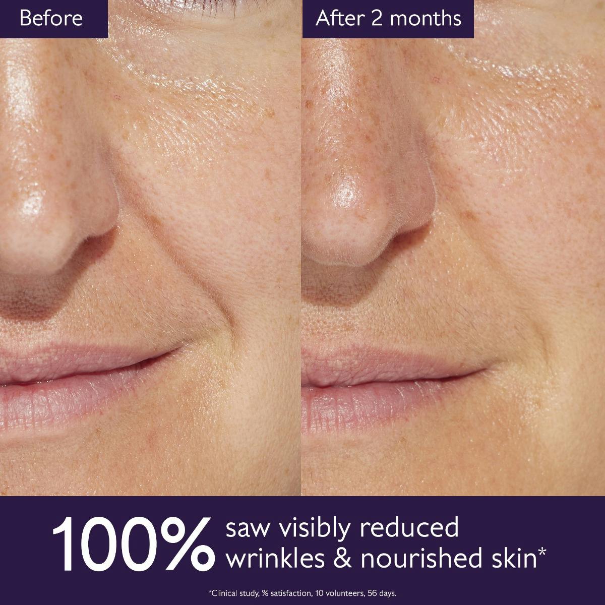 Anti-Aging Routine for Fine Lines and Wrinkles