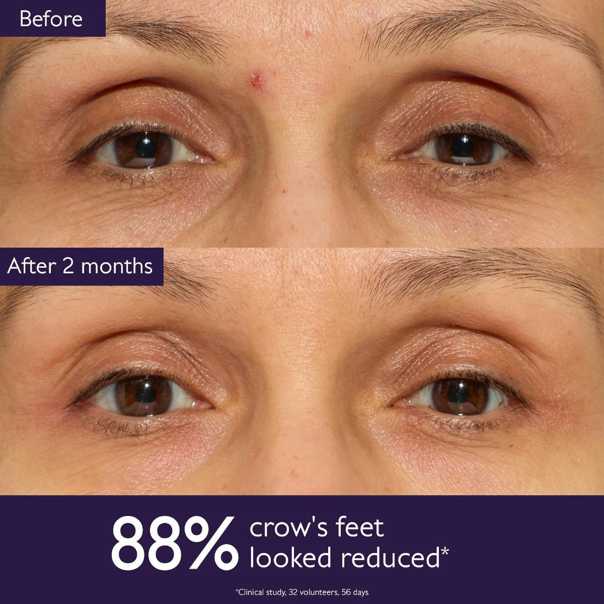 The Anti-Aging Routine for Fine Lines and Wrinkles