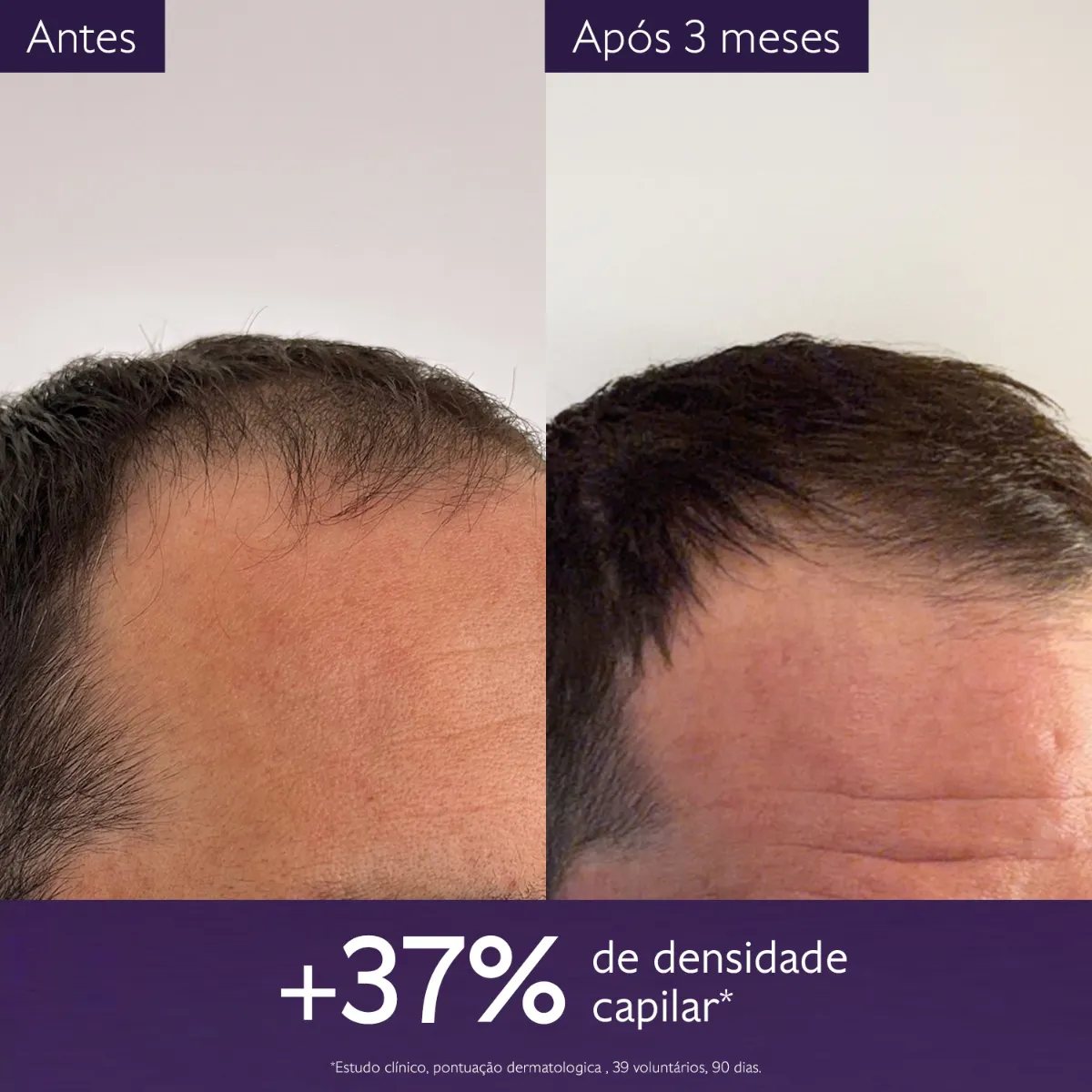 Sérum Densidade Capilar
