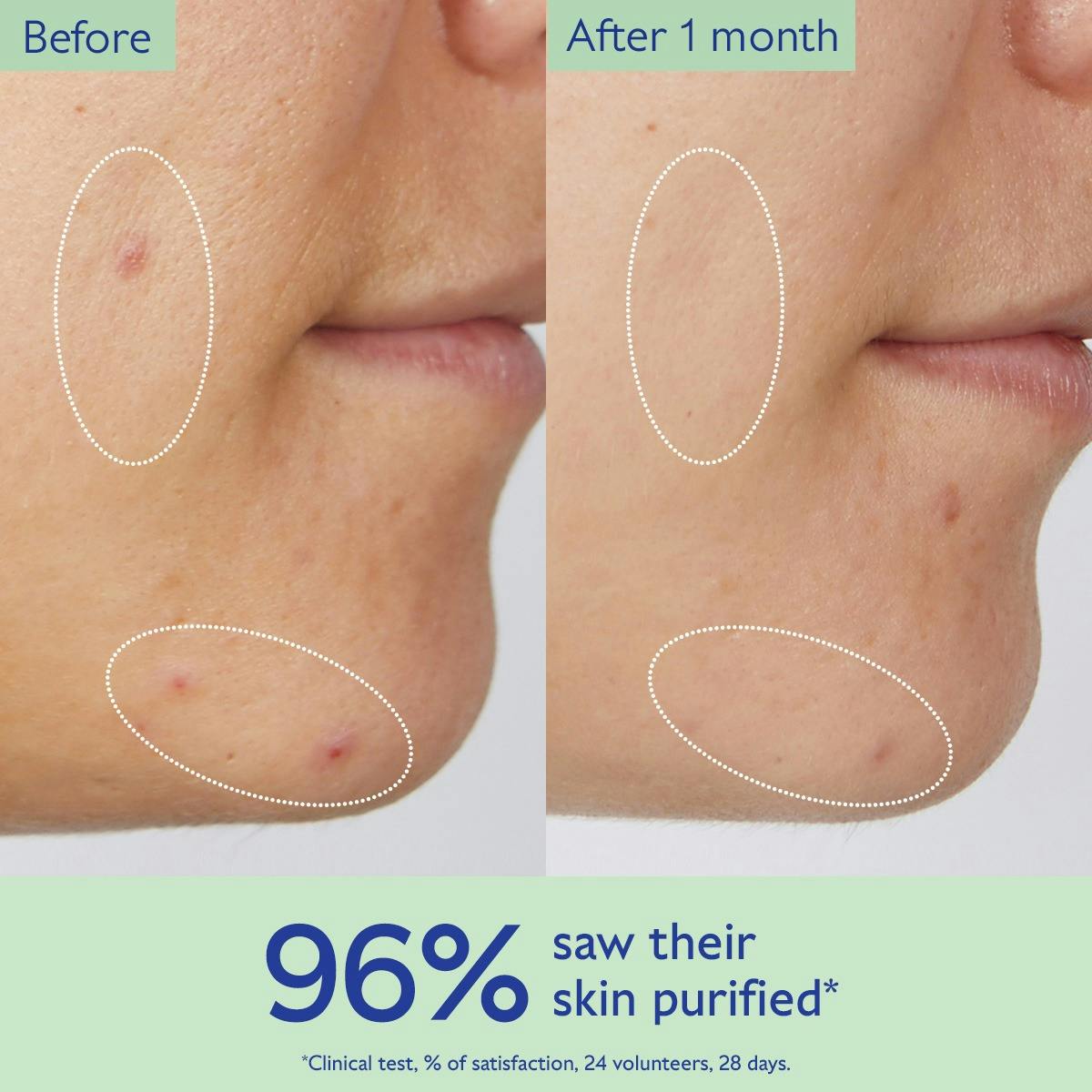 Pore Purifying Gel Cleanser