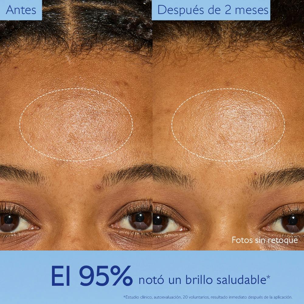 Hidratante con Niacinamida Anti Manchas - Recarga