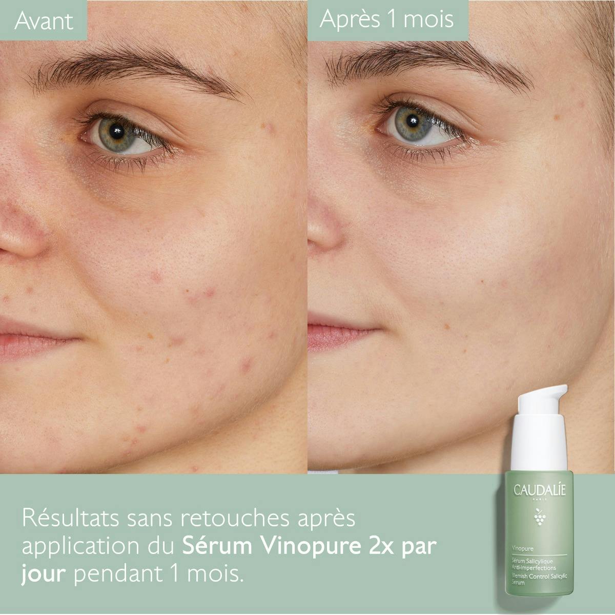 Essentiels pour peaux à tendance acnéique