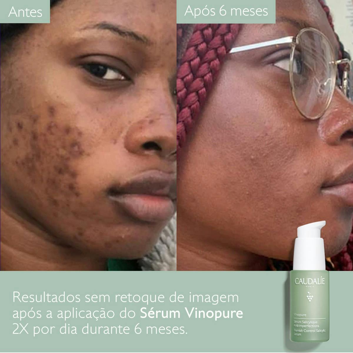 Serum Minimizador del Poro con Ácido Salicílico