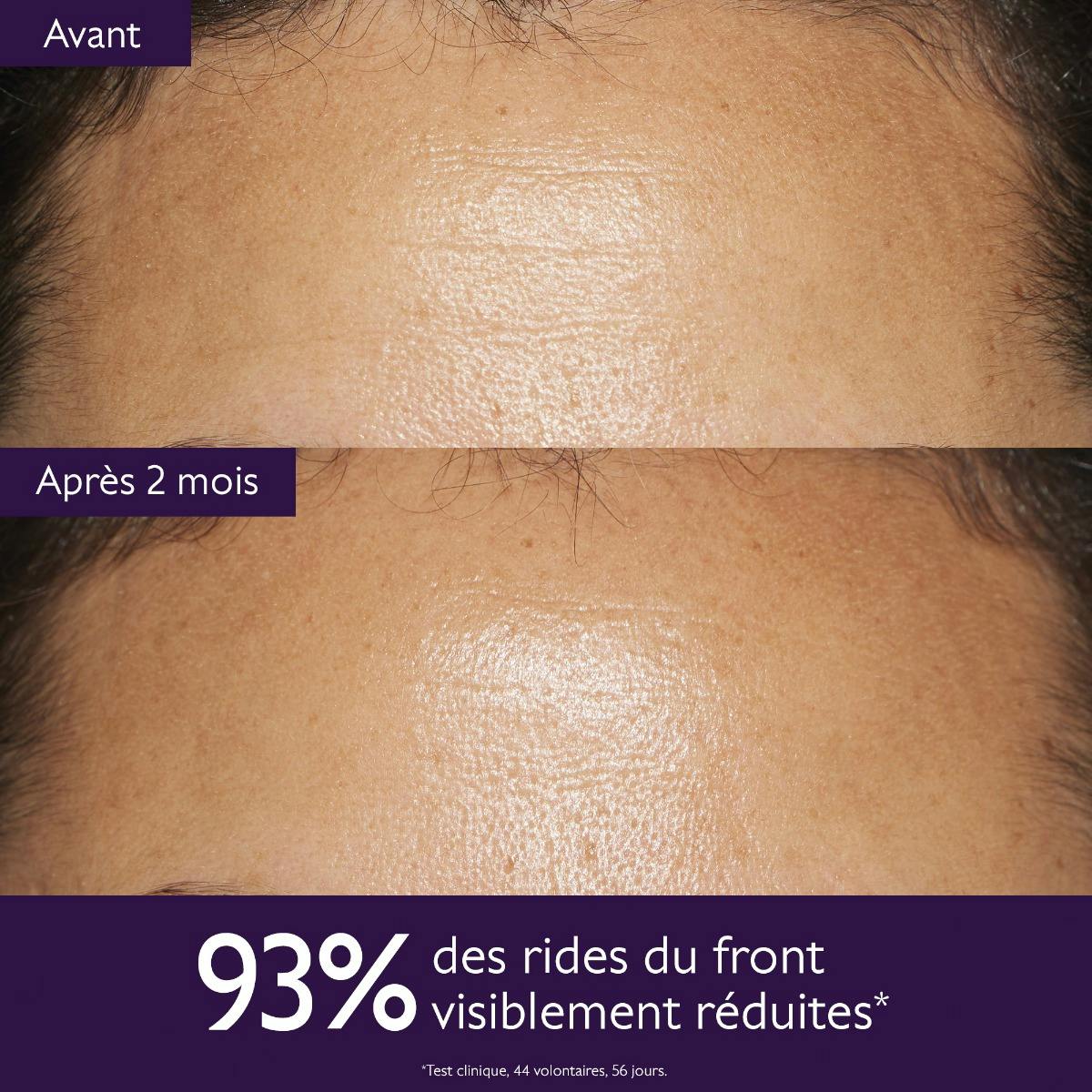 Crème anti-âge global