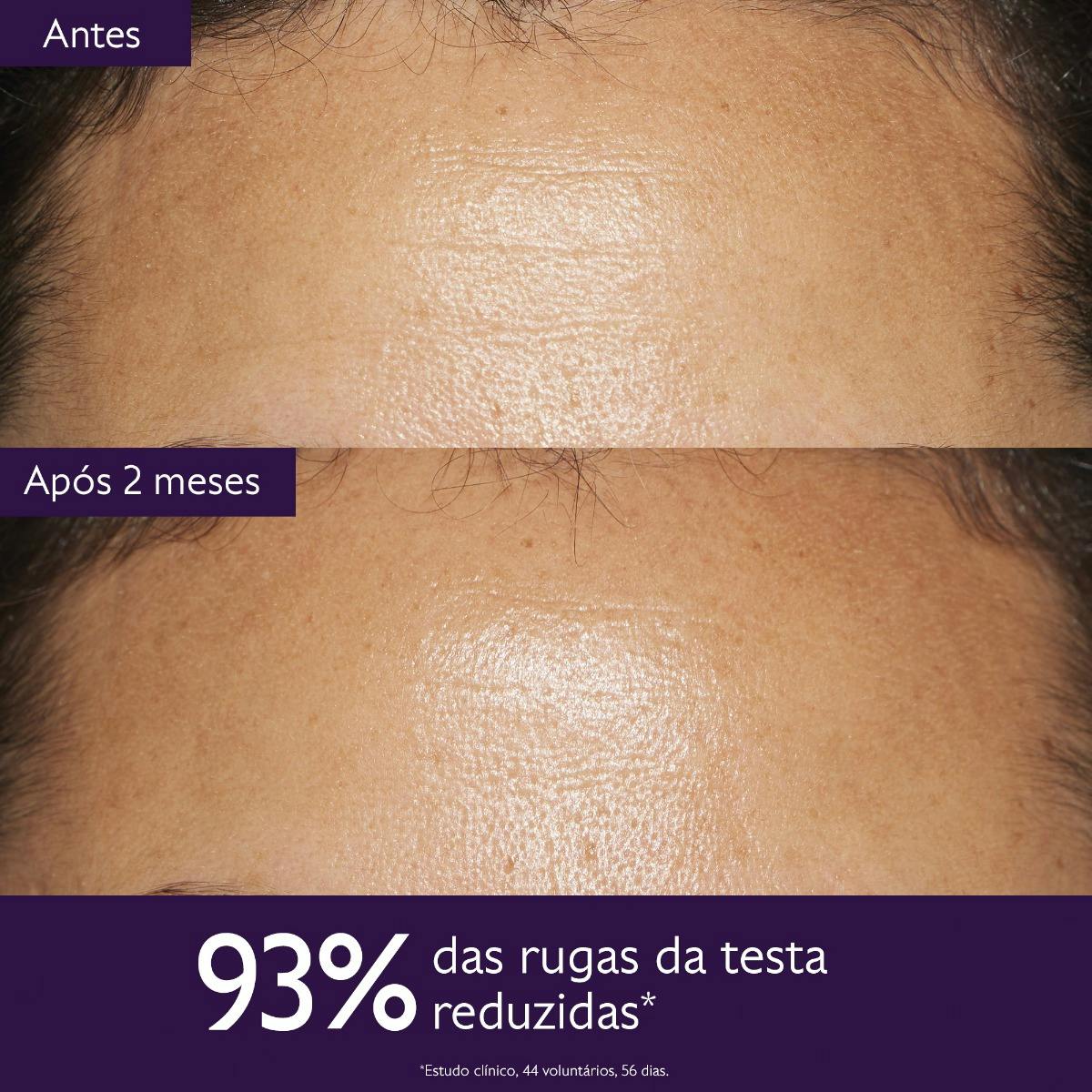 Kit Antienvelhecimento para Rugas e Linhas Finas