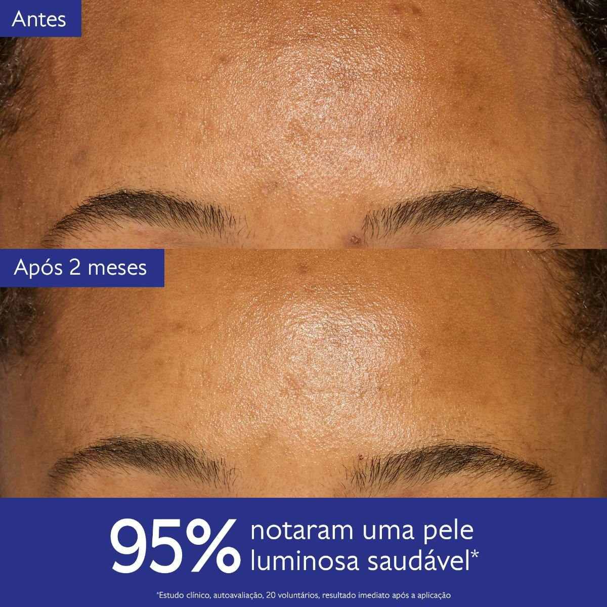 Creme Hidratante Antimanchas com Niacinamida