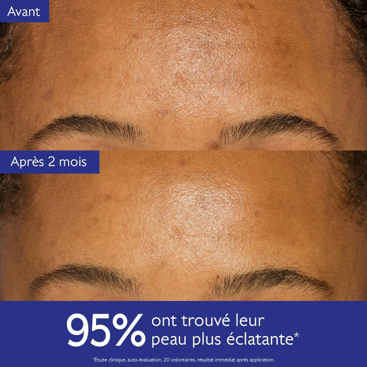 Crème Éclat Éclaircissante