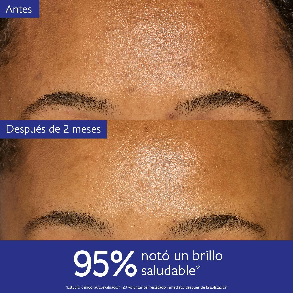 Hidratante con Niacinamida Anti Manchas