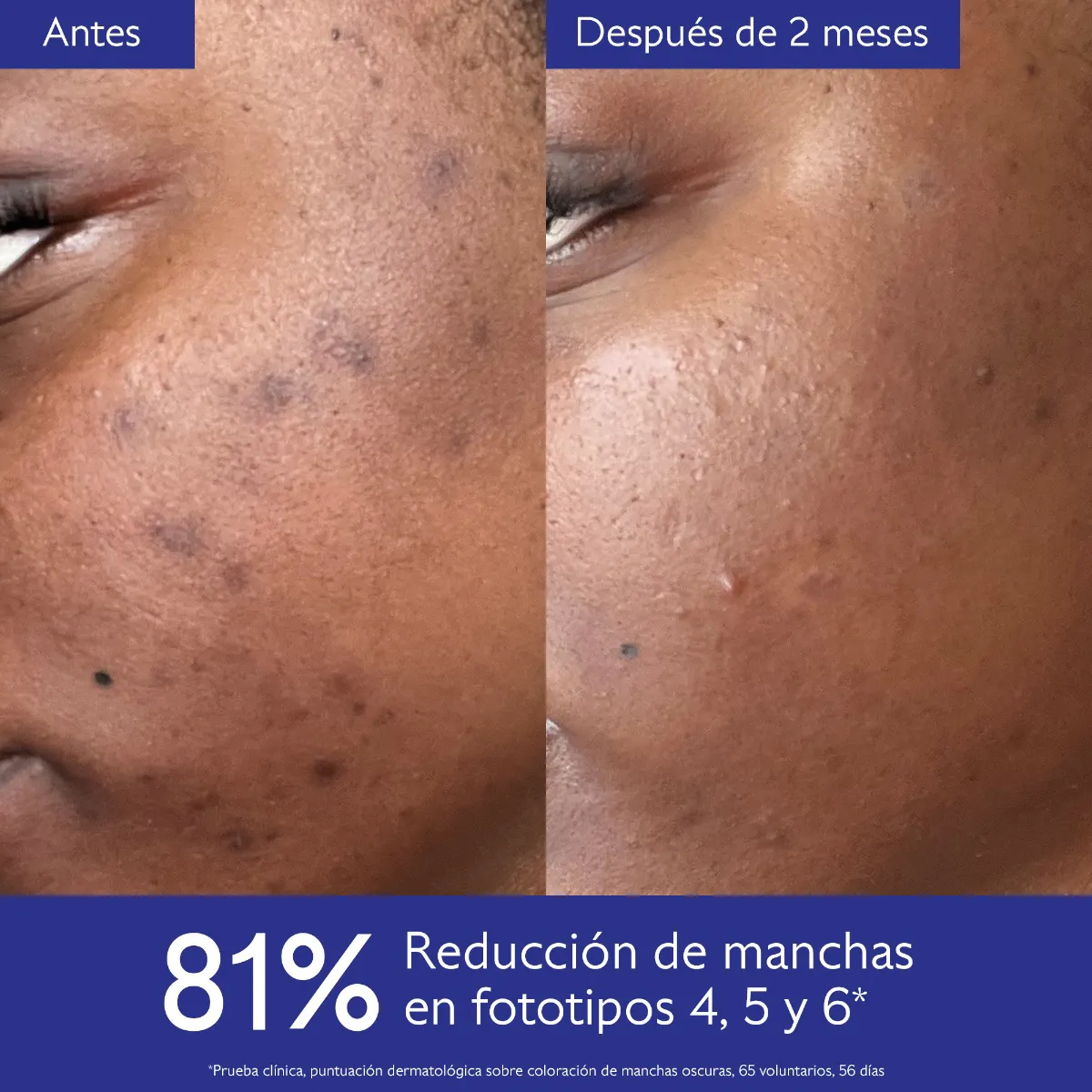 Rutina Iluminadora Vinoperfect para Manchas y Tono de Piel Irregular