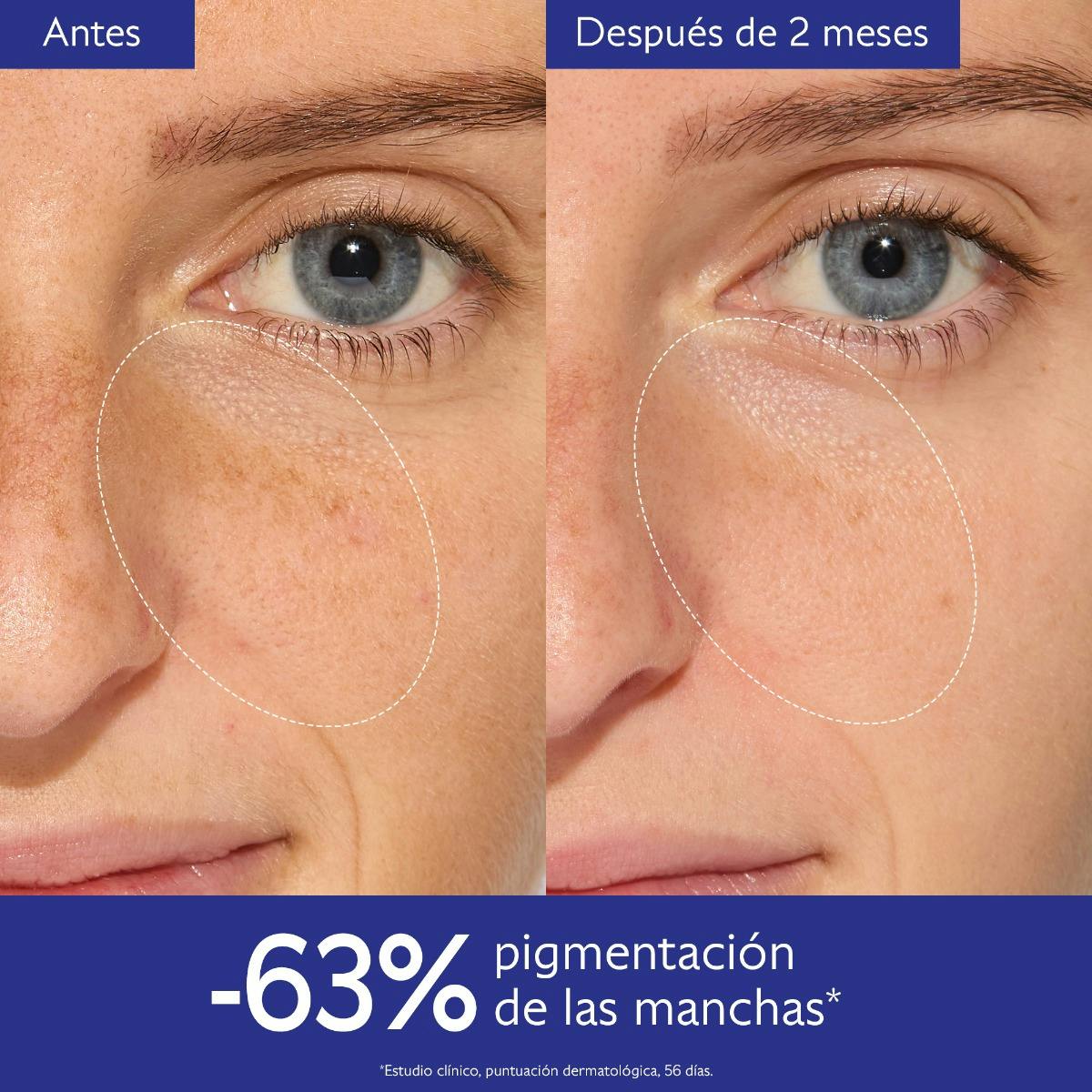 Serum Resplandor Anti Manchas
