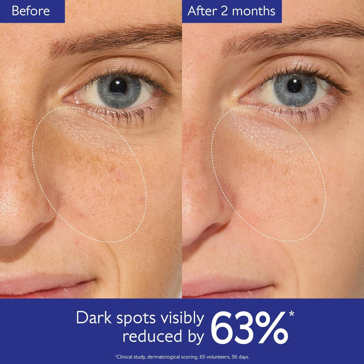 Brightening Dark Spot Serum Vitamin C Alternative