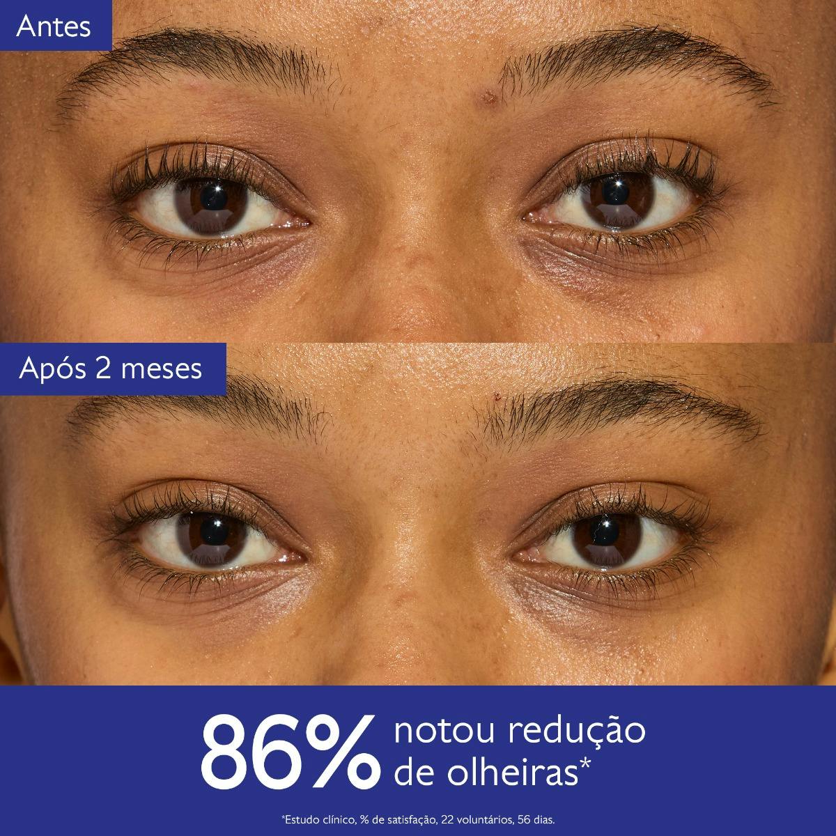 Creme de Olhos Antiolheiras com Niacinamida