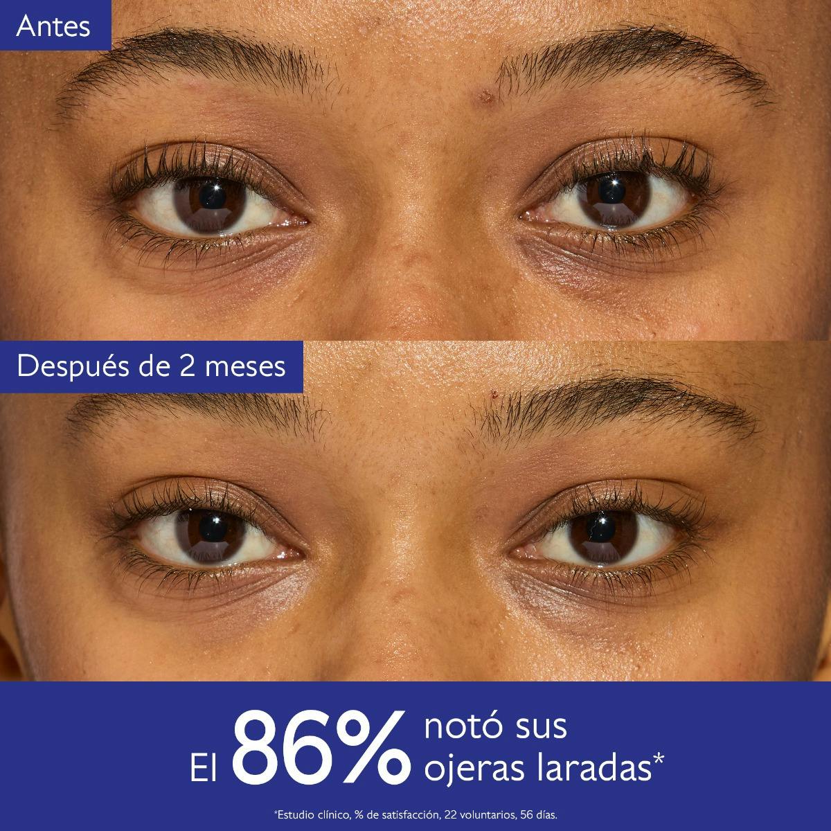 Contorno de Ojos Iluminador con Niacinamida