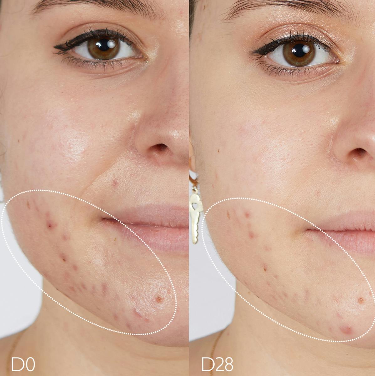 Fluido Matificante Hidratante