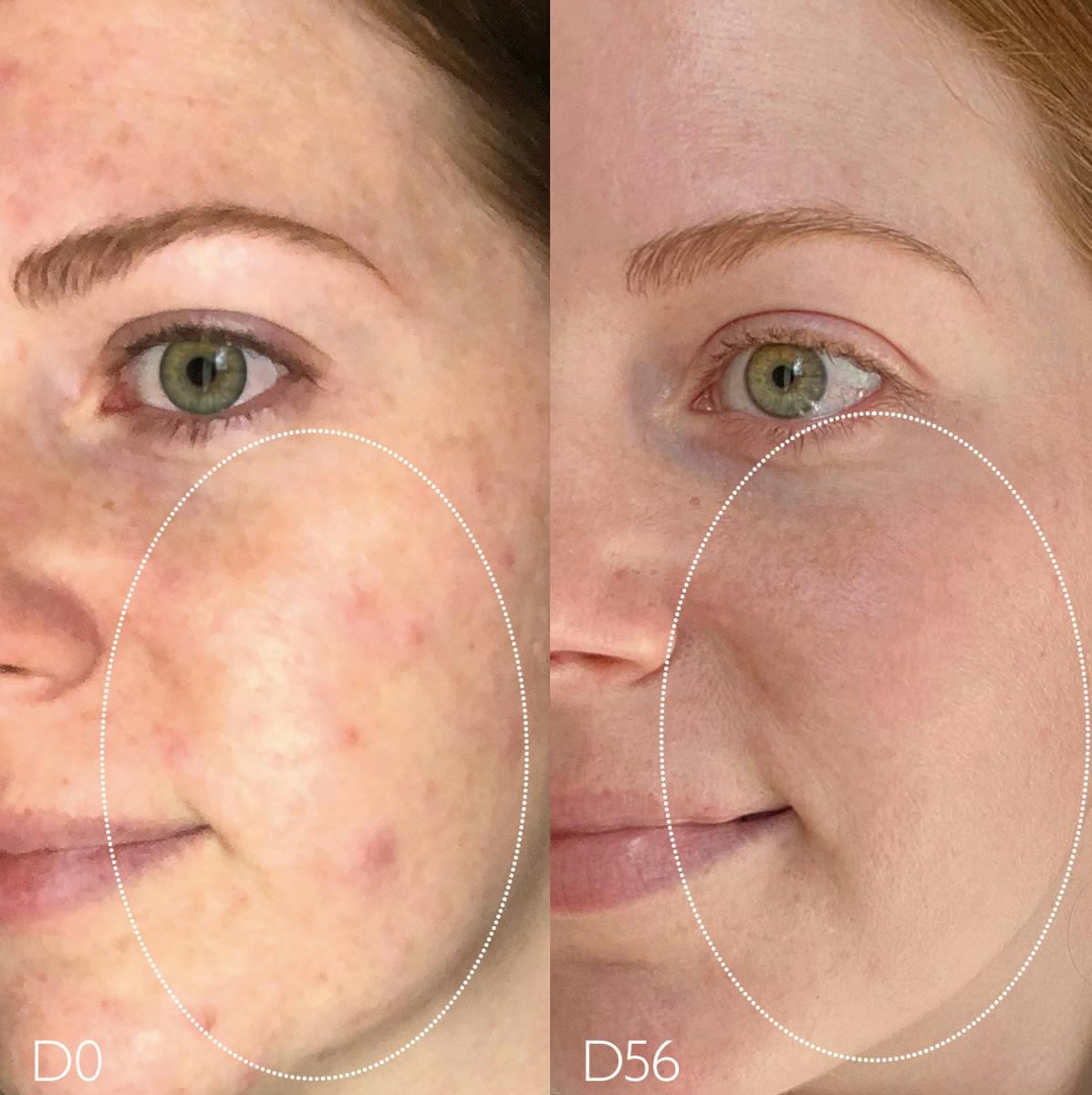 Fluido Matificante Hidratante