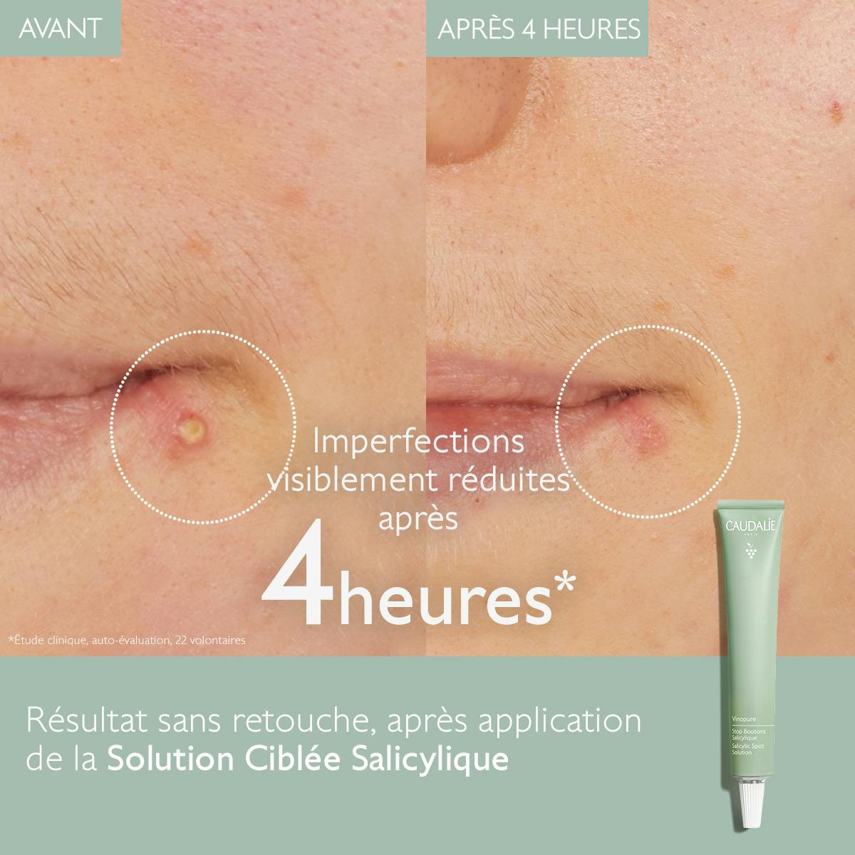 Solution ciblée Correctrice de Couleur à l'Acide Salicylique
