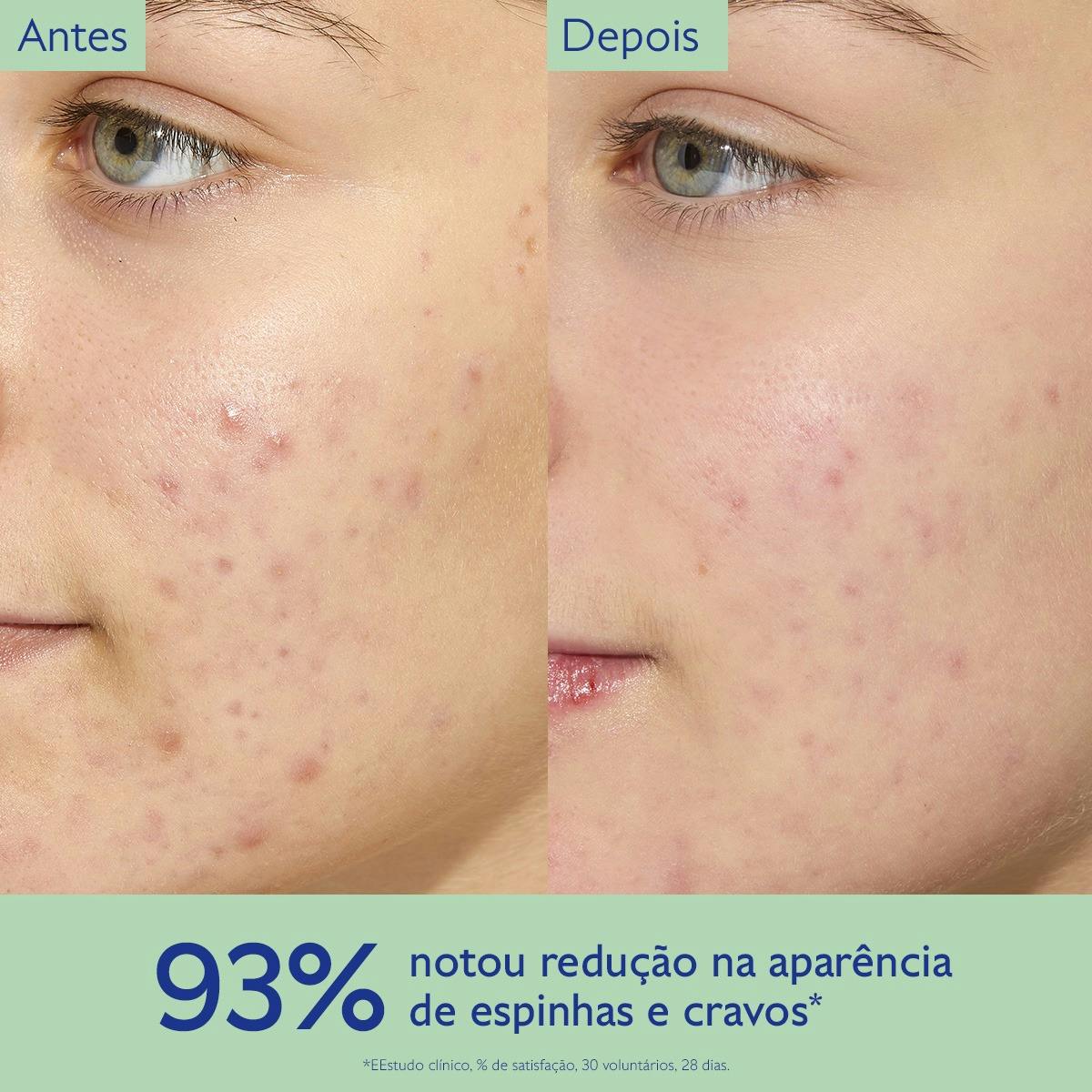 Fluido Matificante Hidratante