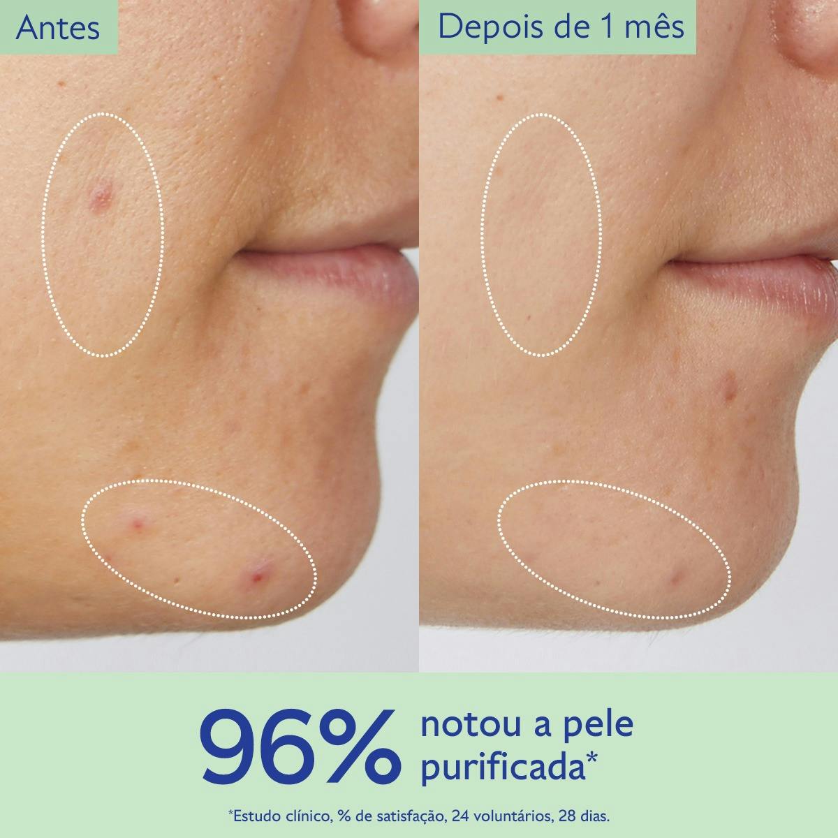Gel de Limpeza Purificante