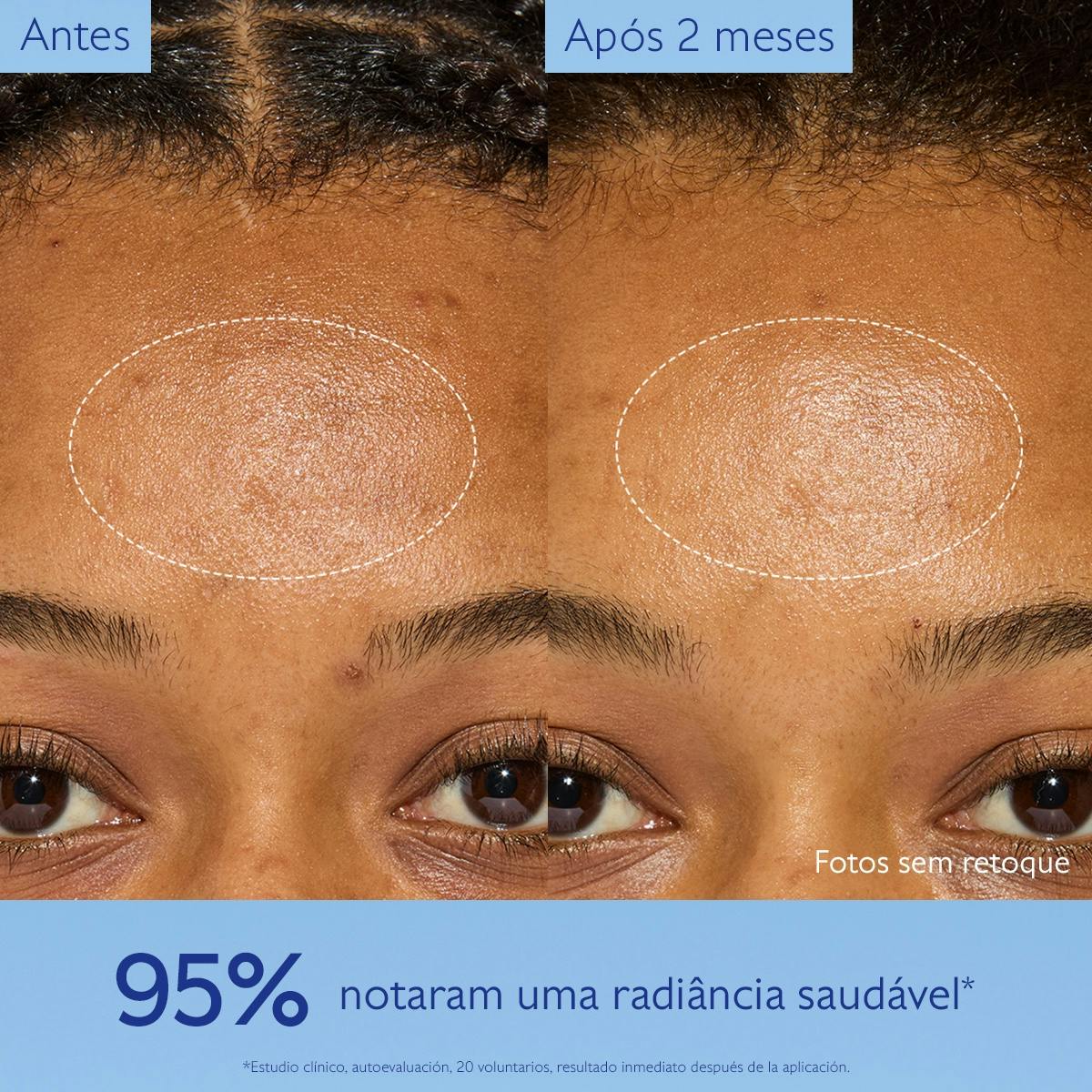 Creme Hidratante Antimanchas com Niacinamida - Refil