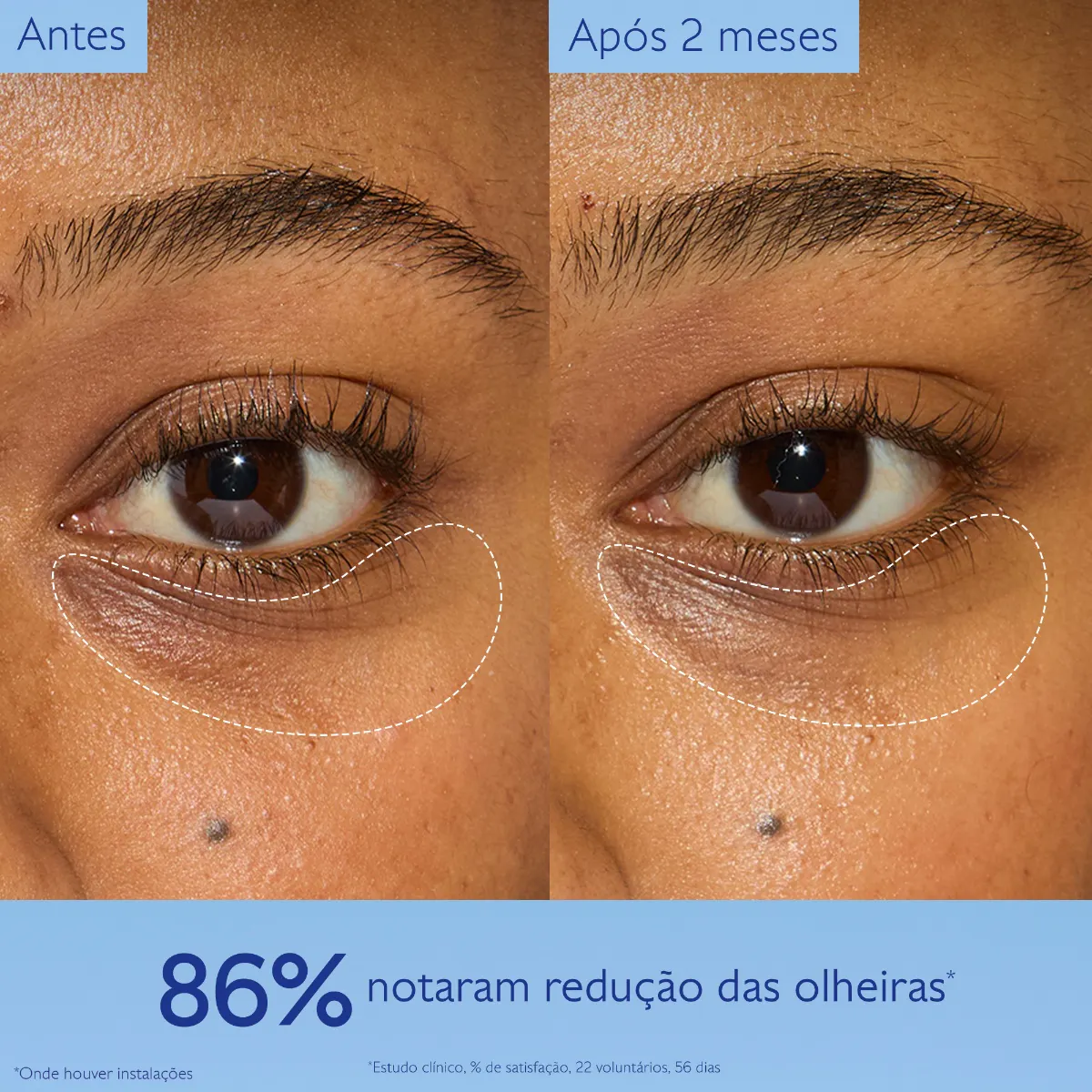 Creme de Olhos Antiolheiras com Niacinamida