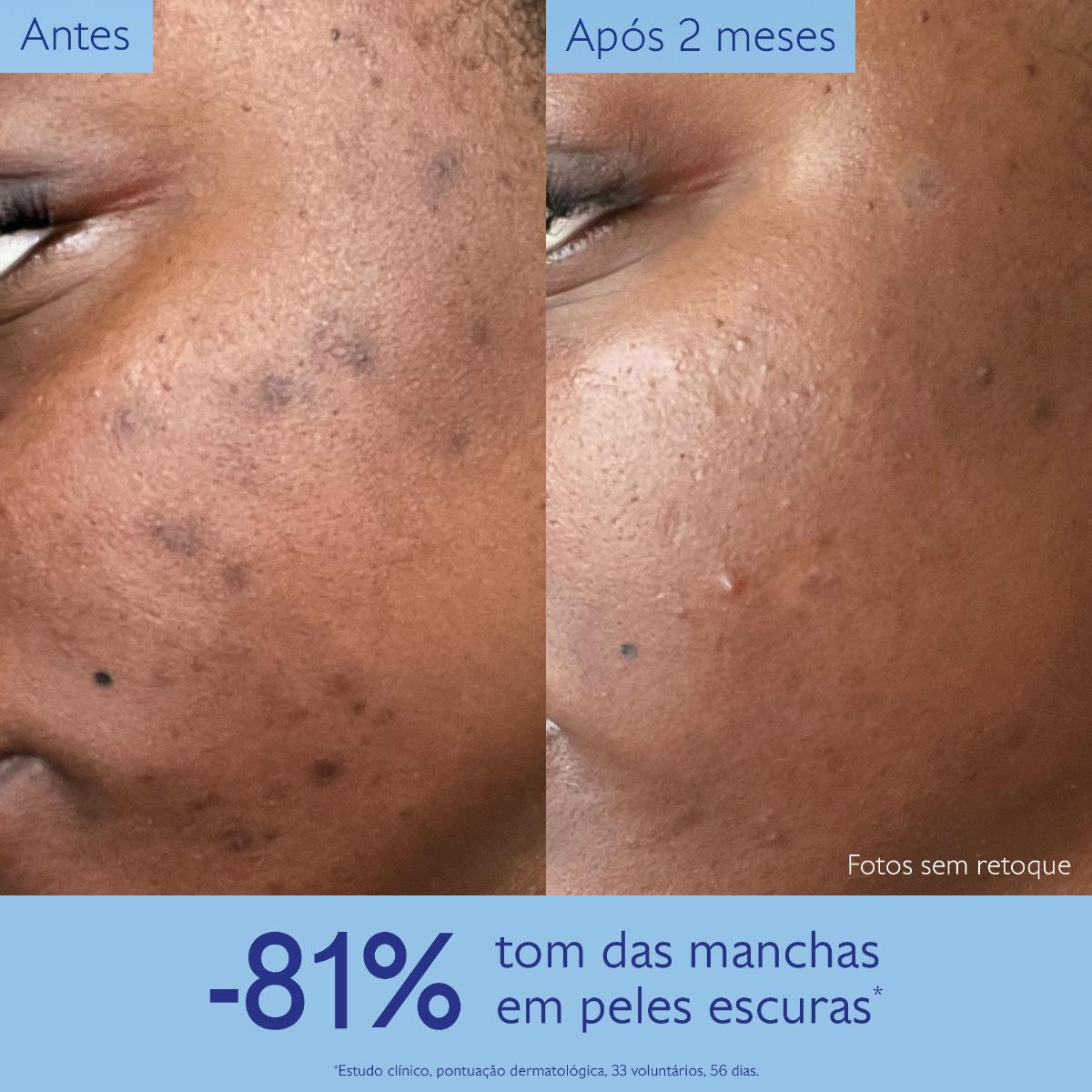 Sérum Iluminador Antimanchas