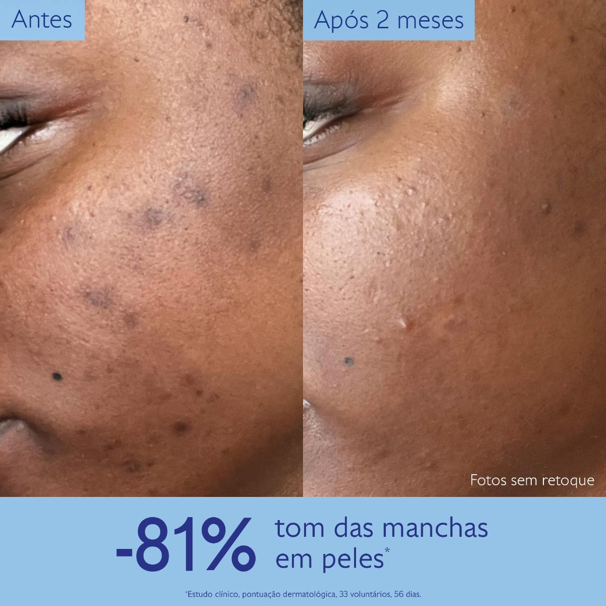 Sérum Iluminador Antimanchas