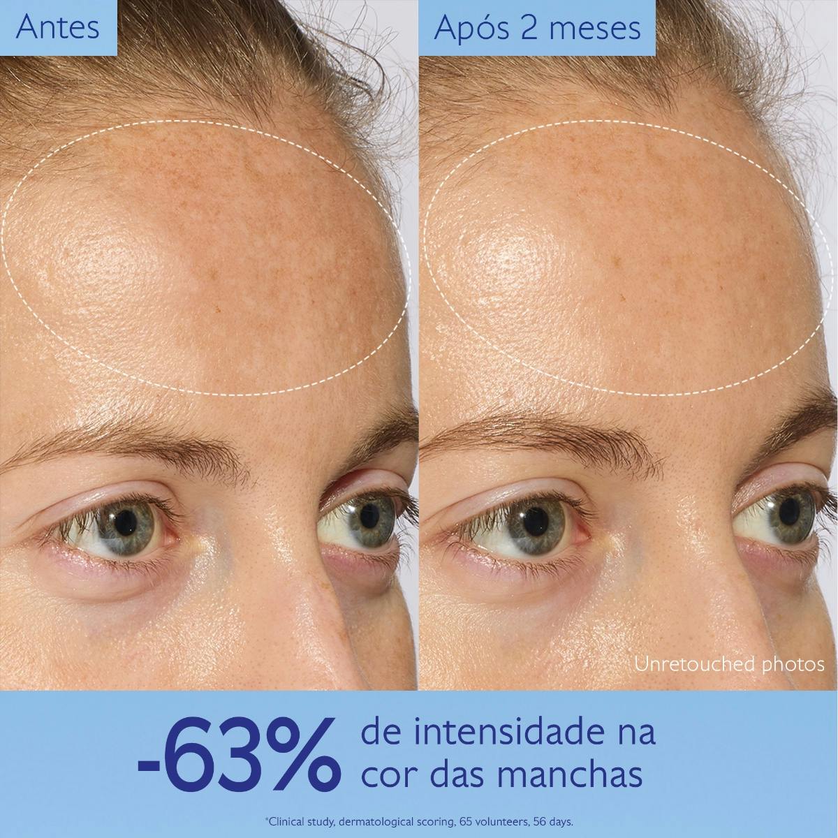 Sérum Iluminador Antimanchas