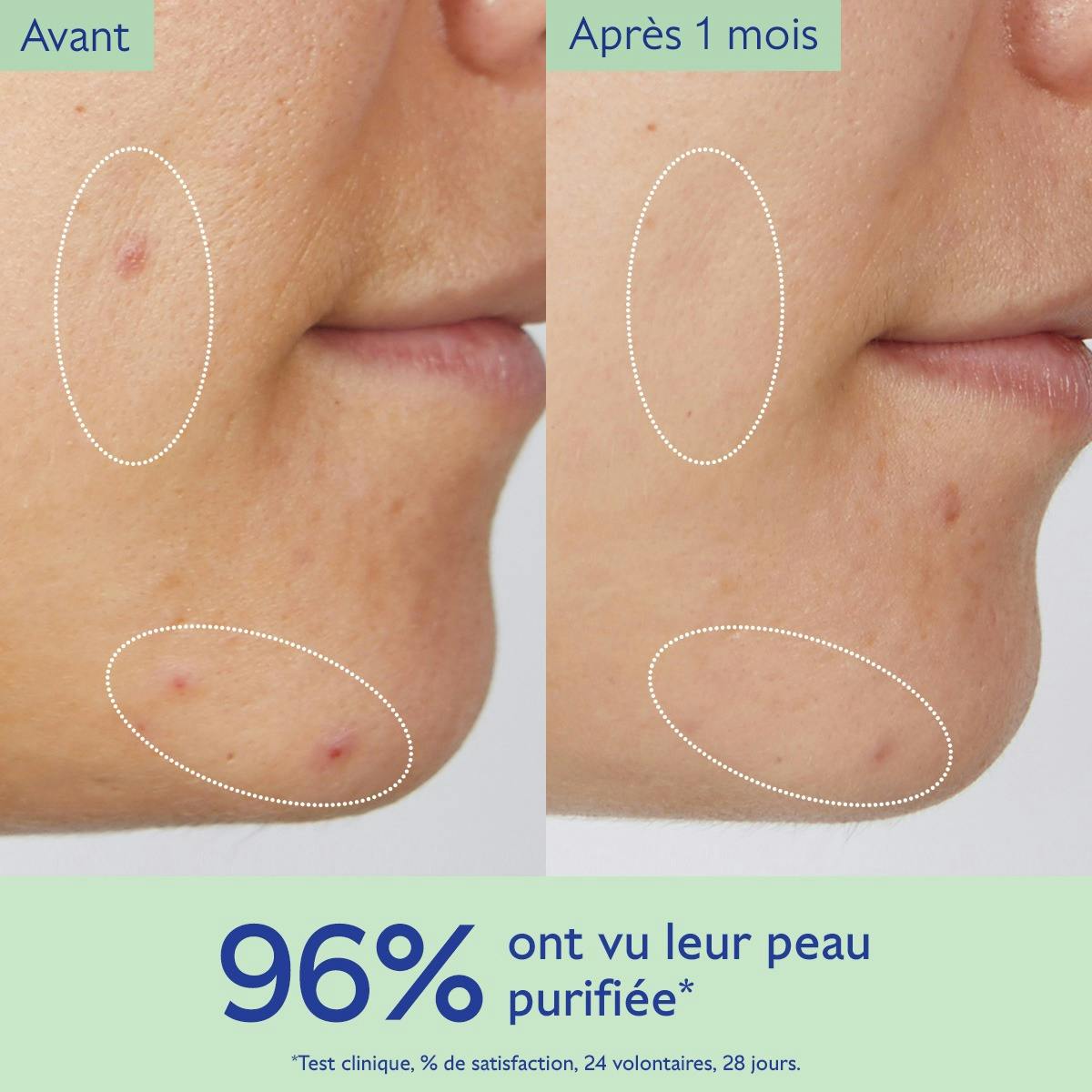 Gelée Nettoyante Purifiante