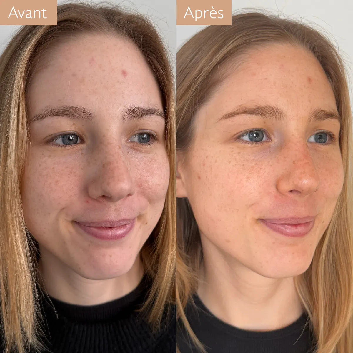 Gouttes Solaires Autobronzantes