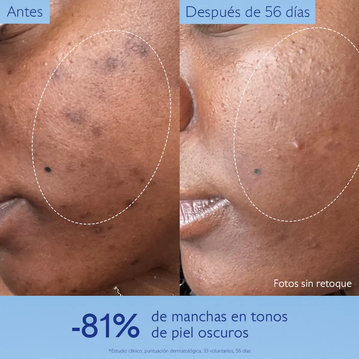 Serum Iluminador Anti Manchas - Alternativa a la Vitamina C