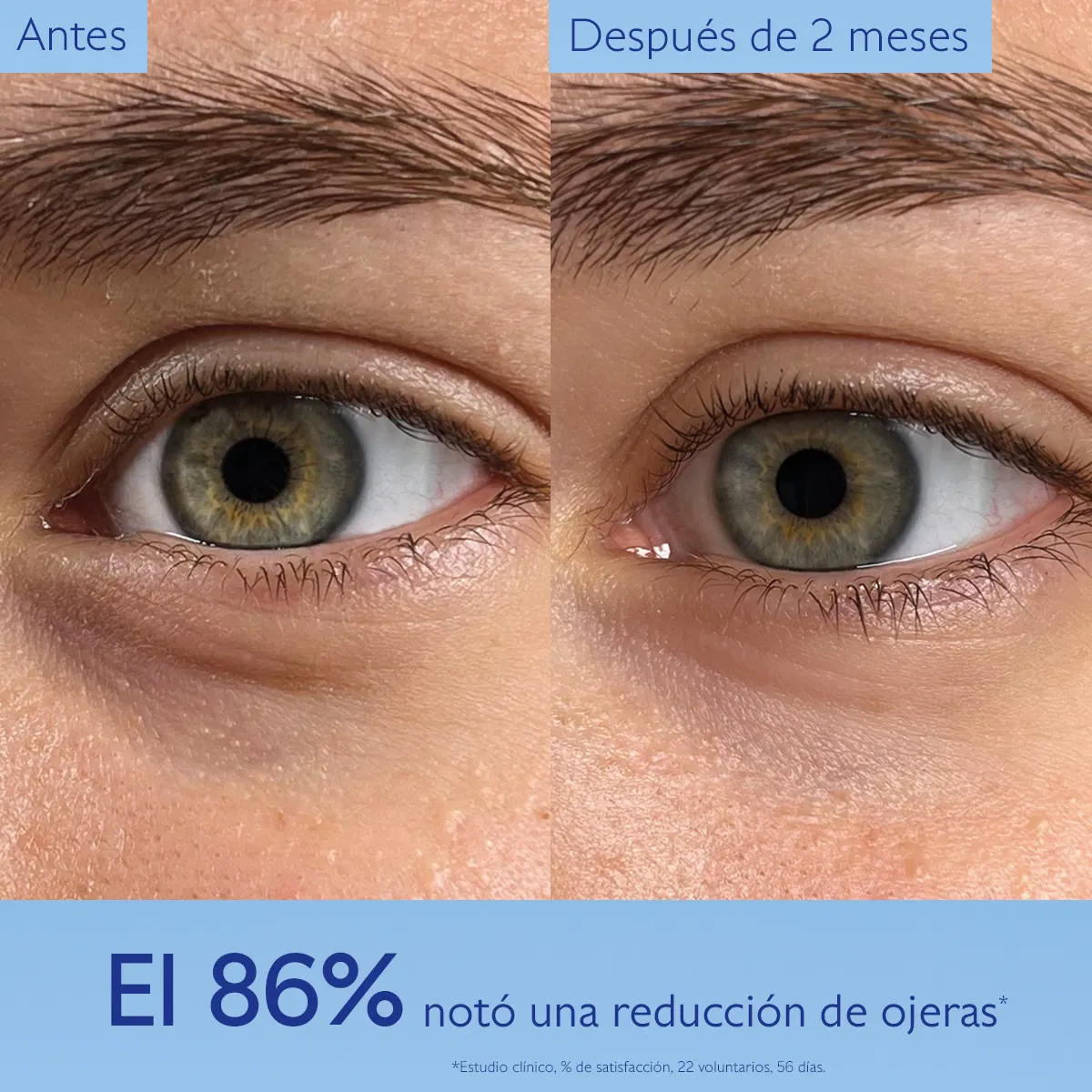 Contorno de Ojos Iluminador con Niacinamida