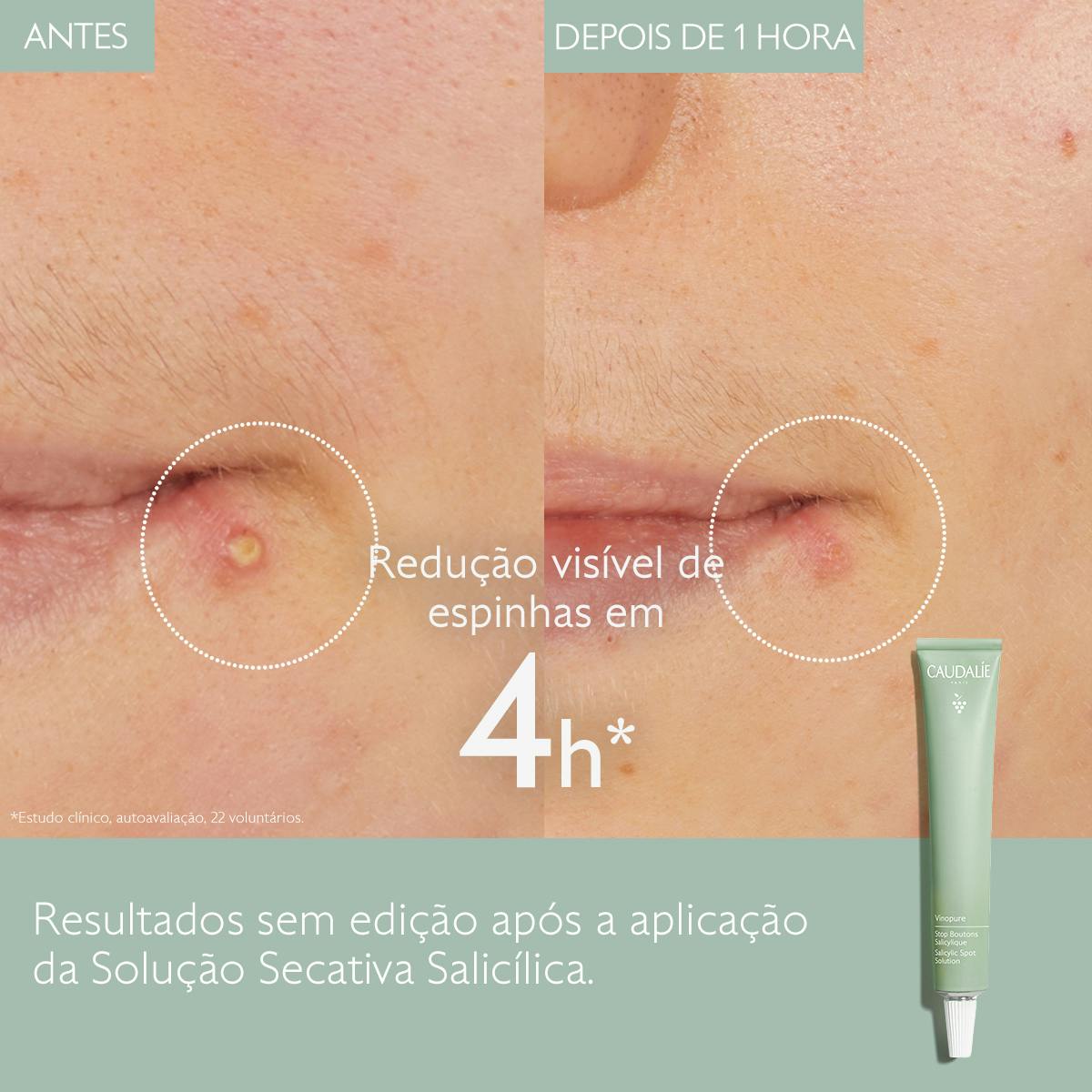 Solução Secativa Salicílica