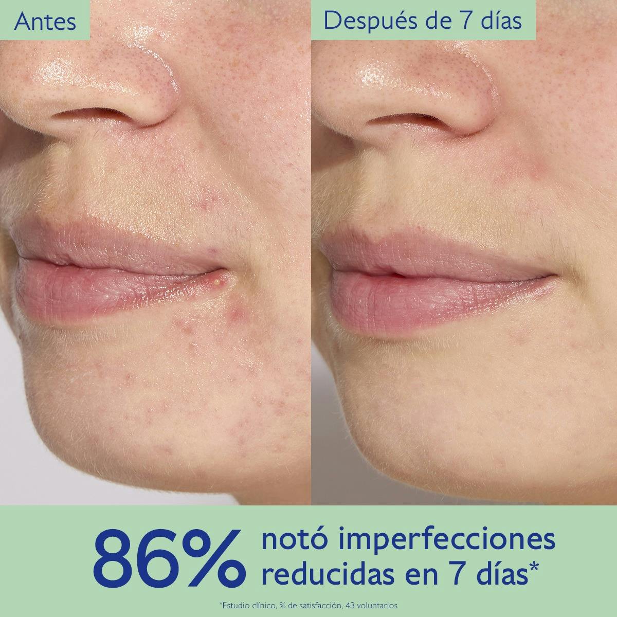 Serum Minimizador del Poro con Ácido Salicílico