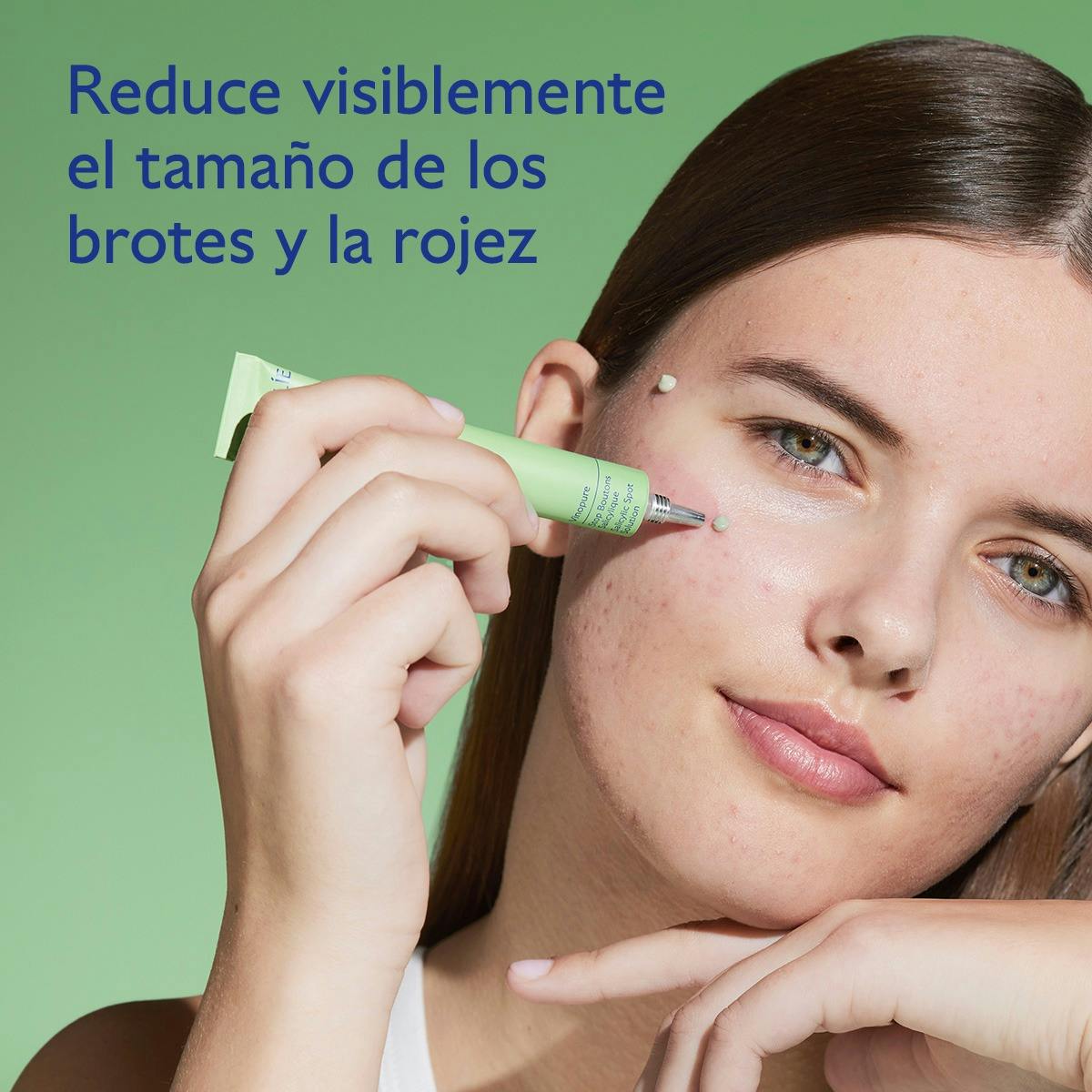 Tratamiento de Ácido Salicīlico Natural