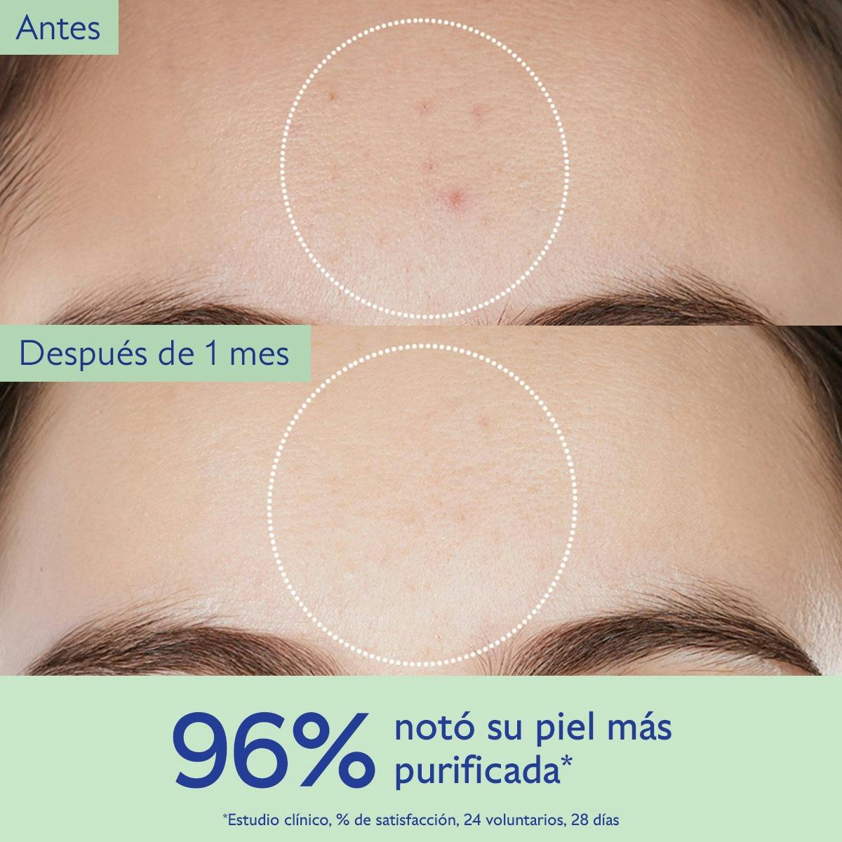 Gel de Limpieza Purificante