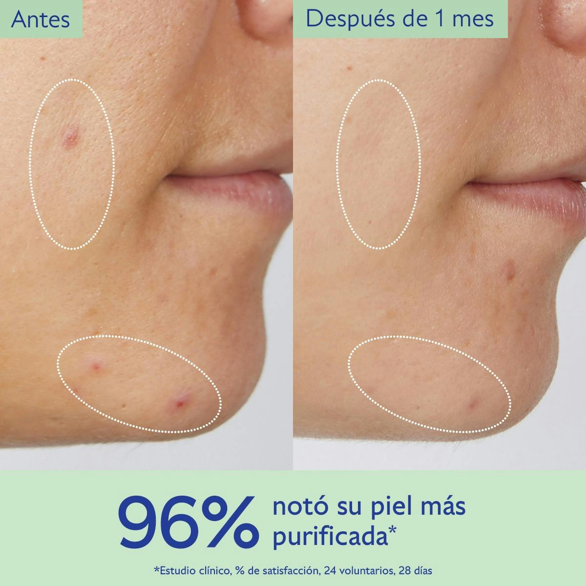 Gel de Limpieza Purificante