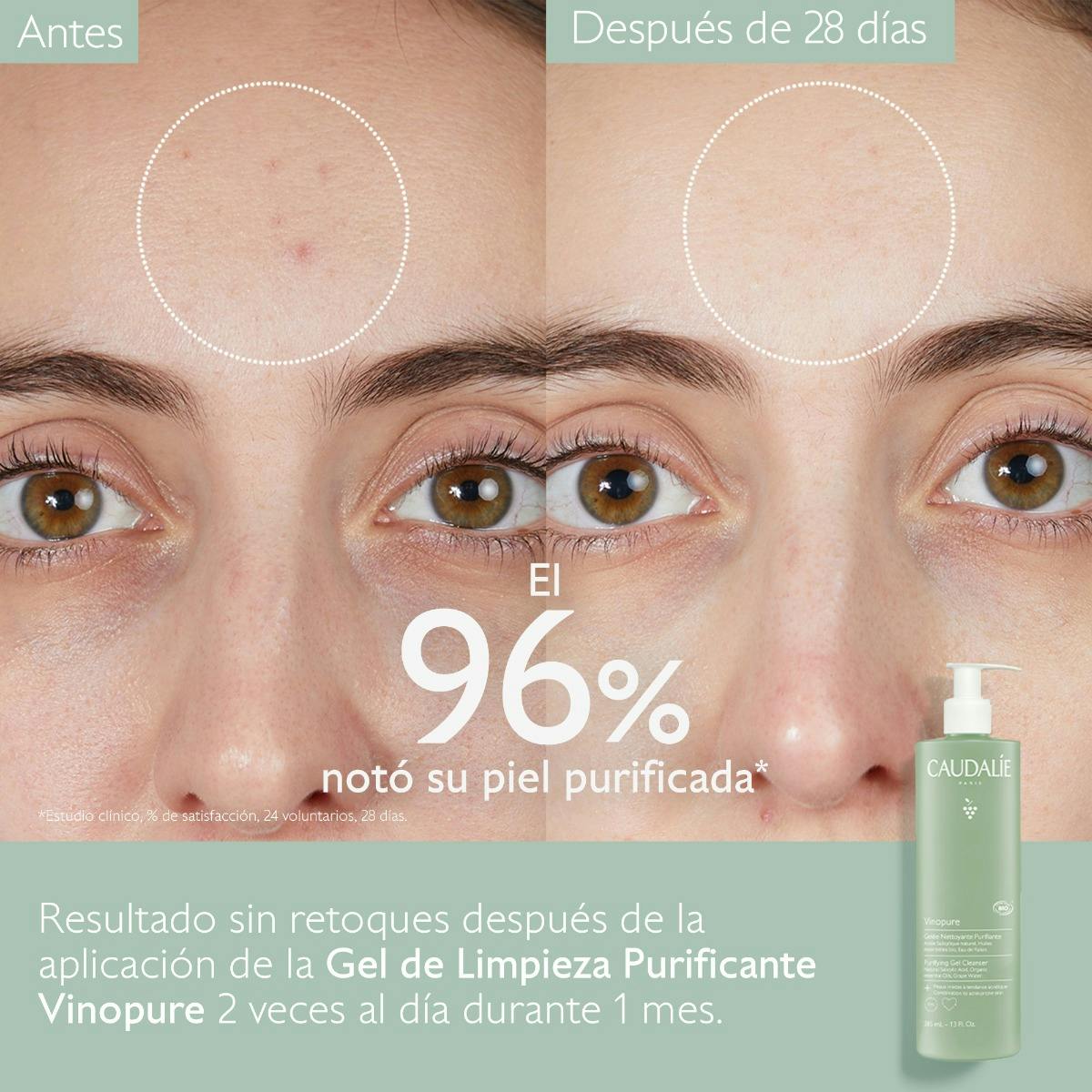 Gel de Limpieza Purificante