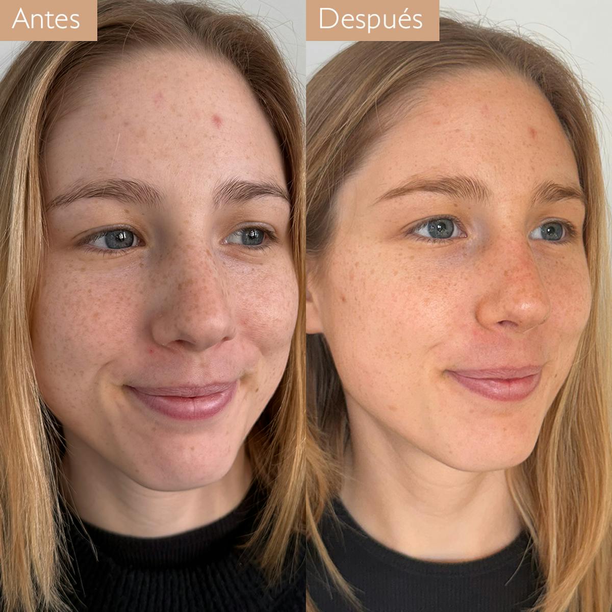 Gotas Solares Autobronceadoras