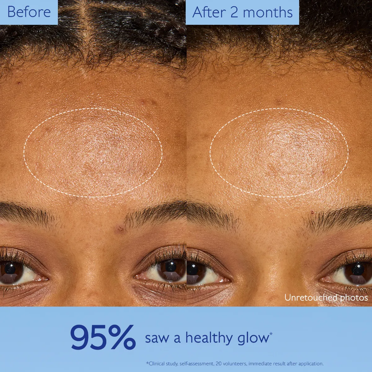 Instant Brightening Moisturizer - Refill