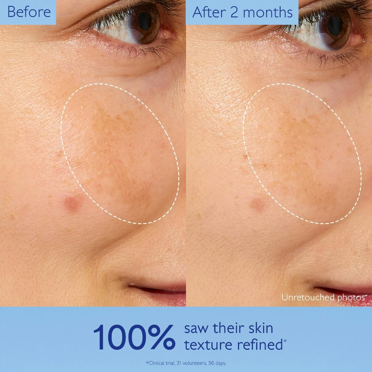 Brightening Glycolic Essence