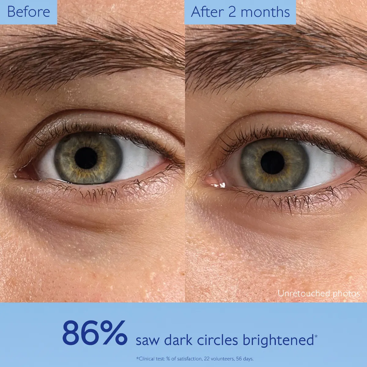 Dark Circle Brightening Eye Cream with Niacinamide