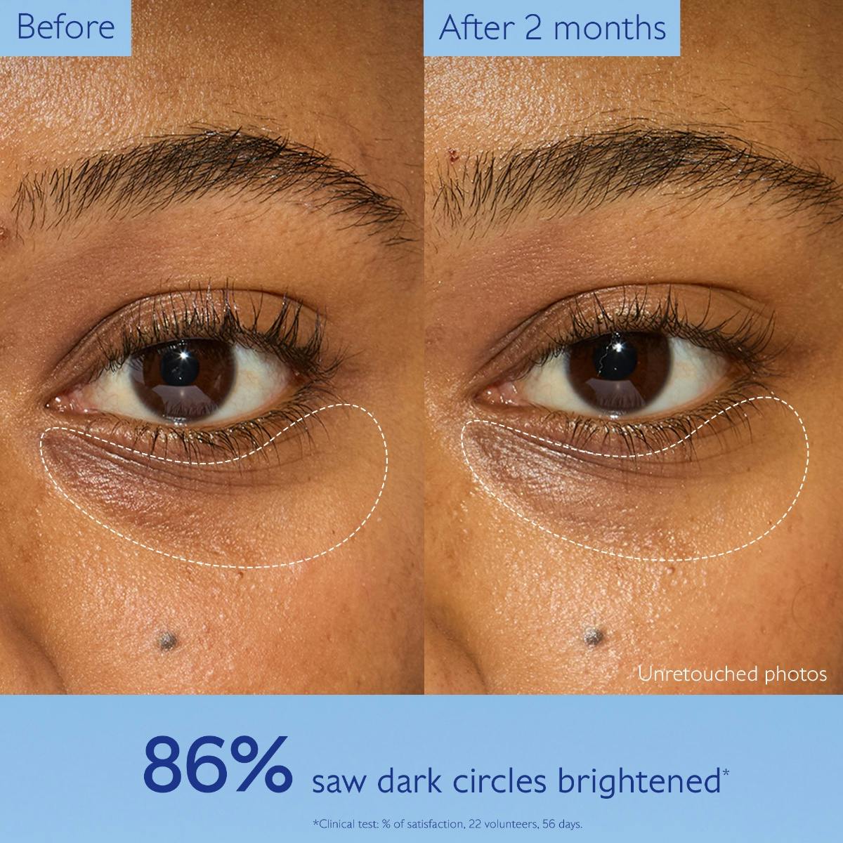 Dark Circle Brightening Eye Cream with Niacinamide