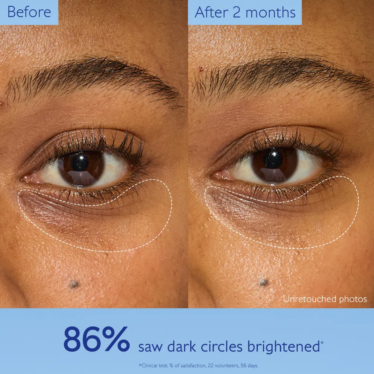 Dark Circle Brightening Eye Cream with Niacinamide